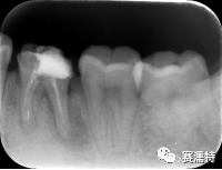 喻刚老师案例